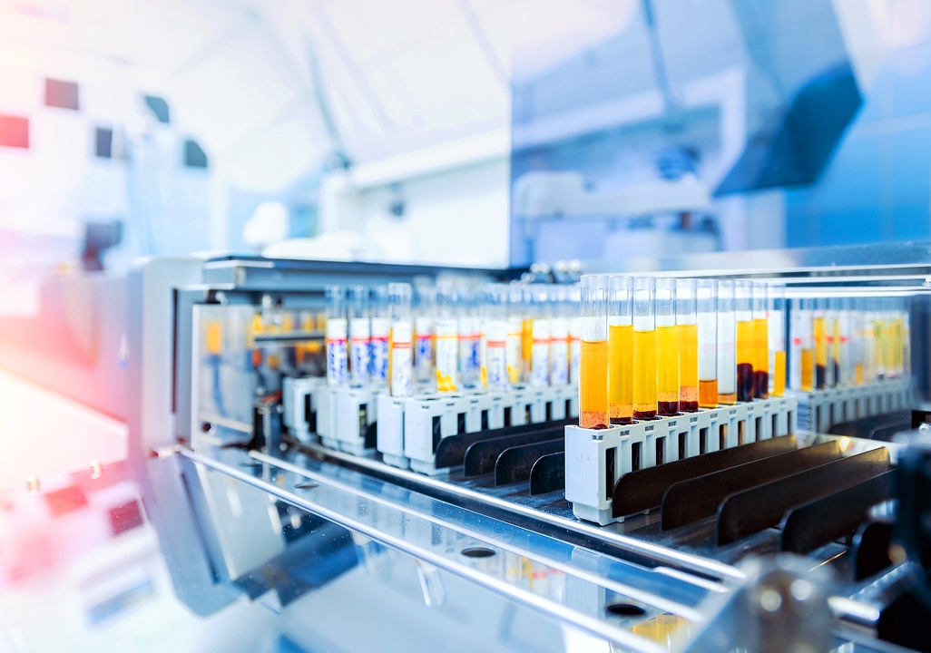 Automated lab analyzer processing test tubes filled with yellow samples.