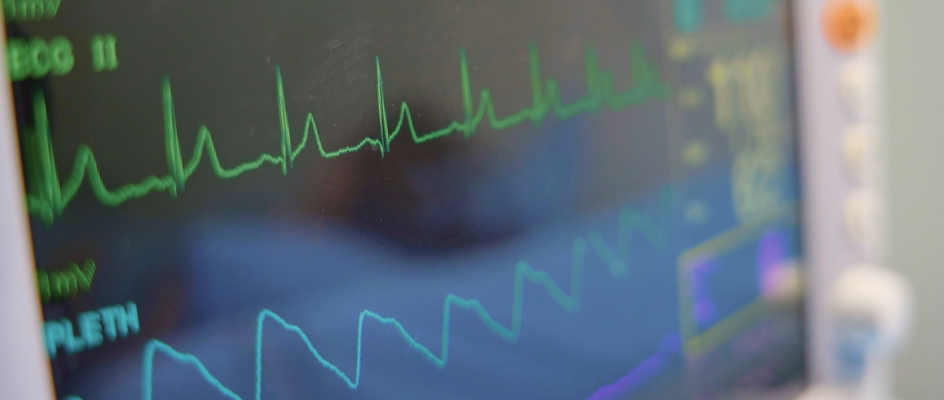 Close-up of a hospital patient monitor displaying ECG and vital sign waveforms.
