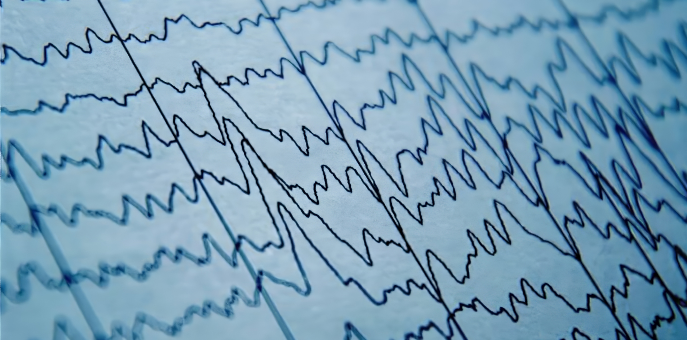 Close-up of EEG waveform traces on paper.